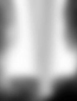 Cra*** - Odelzhausen