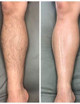 Waxing für Sie und Ihn - München Maxvorstadt