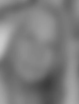 dia*** - Völklingen