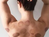 Massage feuerschröpfen Wärme Massage - Villingen-Schwenningen