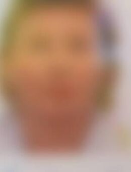 5MO*** - Birkenfeld (Rheinland-Pfalz)