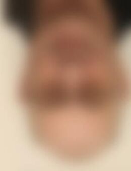 And*** - Schondorf (Ammersee)