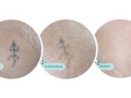 Permanent Make up,Freckles,Remover,Fine Line Tattoart,Gesichtsbehandlungen.... - Saarlouis