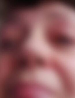 bro*** - Saarbrücken