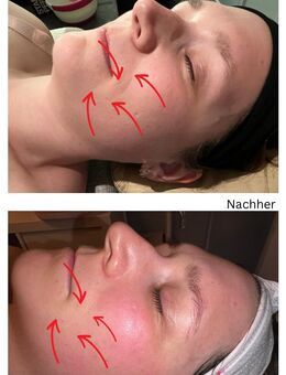 Kostenloses Bio-Facelifting in Chemnitz - Chemnitz