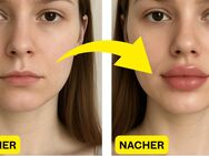 Vollere Lippen ohne Spritze – natürliche Pflege & Massage *Eröffnungsangebot* - Hannover