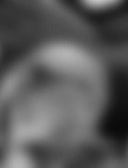 Nor*** - Bad Kreuznach