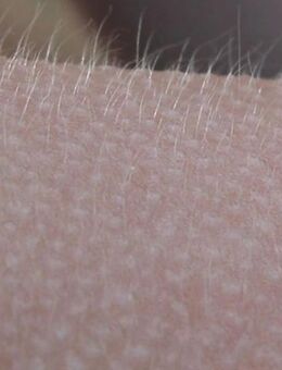 Gänsehaut durch streicheln - Möckmühl