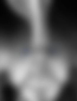 Kük*** - Herleshausen