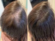 Modelle gesucht für Haarpigmentierung! - Frankfurt (Main) Sachsenhausen-Nord