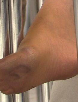 Ist hier Vielleicht eine Alte Oma sehr gerne auch sehr Alt die Noch Nylonstrumpfhosen hatt die Nicht mehr gebraucht werden. - Bremerhaven