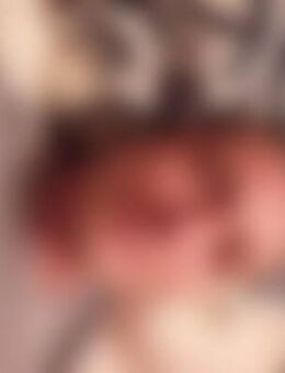 Art*** - Saarbrücken