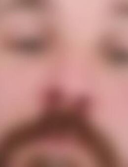 MRE*** - Freiburg (Breisgau)