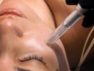 Microneedling & Microdermabrasion Angebot - Berlin