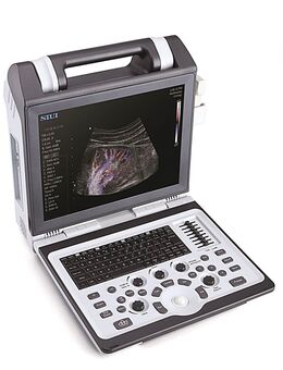 Mobile Ultraschallgeräte SIUI Apogee 2100 - Stolberg (Rheinland, Kupferstadt)
