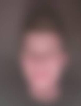 ChR*** - Thalmassing