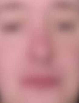 Mar*** - Waldlaubersheim