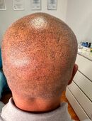 Haarpigmentierung in 48691