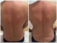 💥Chiropraktiker💥Aktion nur 90€ - Berlin
