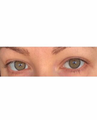 Profil