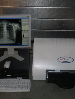 Kodak Orex PcCR 1417 ACL4 Digital X-ray Röntgen Imaging - Zürich