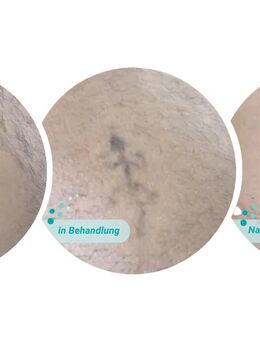 Permanent Make up,Freckles,Remover,Fine Line Tattoart,Gesichtsbehandlungen.... - Saarlouis