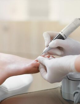 Fußpflege muß nicht schmerzhaft und teuer sein.. - Gelsenkirchen Bulmke-Hüllen